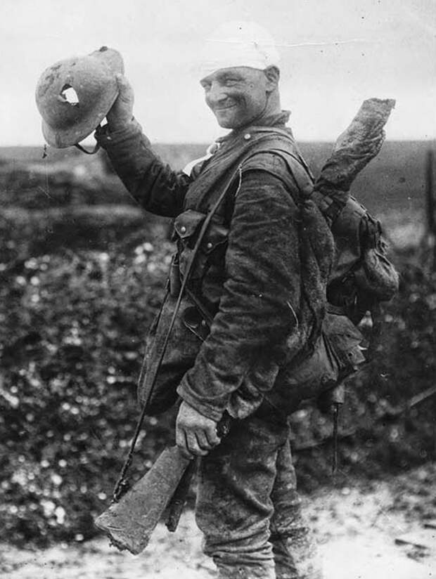 Lucky British soldier shows off his damaged helmet, 1918