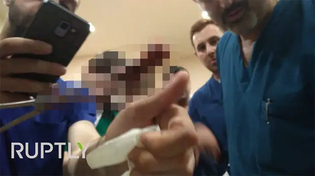 «Попытка переворота»: десятки человек пострадали в ходе столкновений у здания парламента Грузии