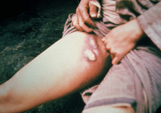 CDC