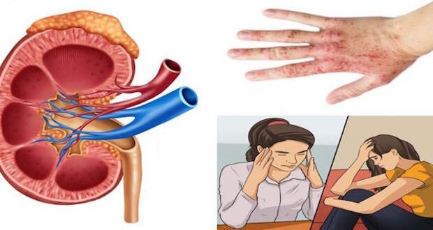 kidneys-danger-6-signs-shouldnt-ignore
