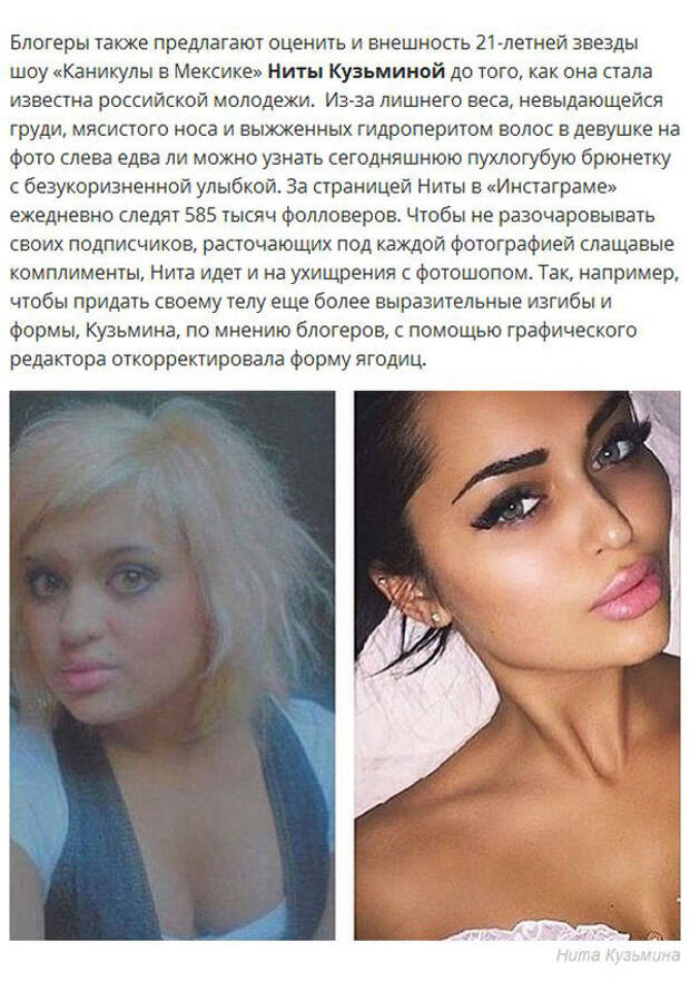 Фото Ниты Кузьминой До Операций