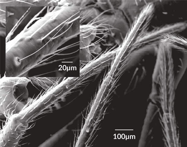 a scanning electron microscope image of the fine hairs on a spider leg