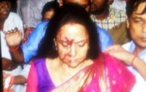 В Индии попала в аварию исполнительница главной роли в фильме "Зита и Гита"