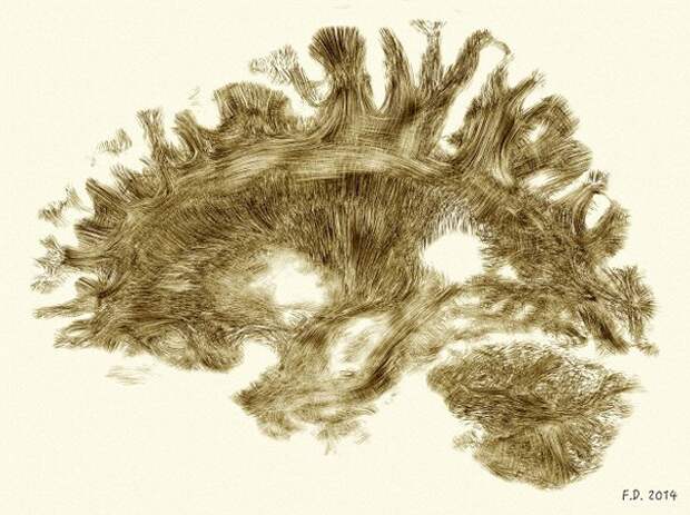 Мозг здорового взрослого человека. Изображение — трактография на основе МРТ (визуализация проводящих путей на основе магнитно-резонансной томографии).