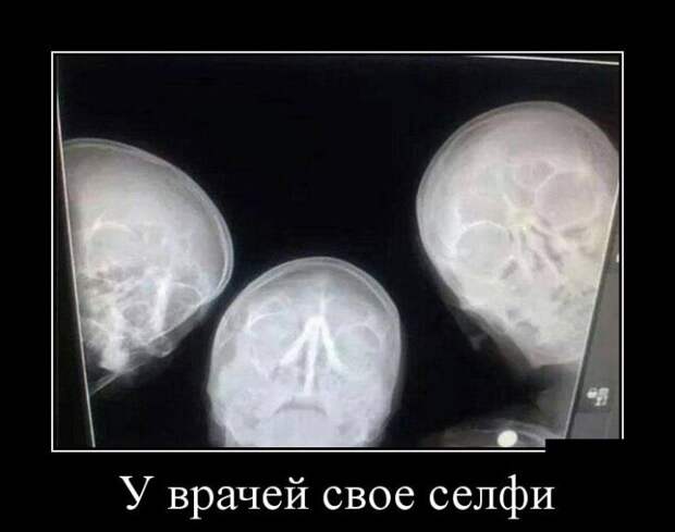 У врачей своё селфи демотиватор, юмор