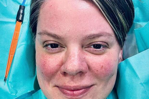 Поэтесса Вера Полозкова рассказала, что ей сделали операцию