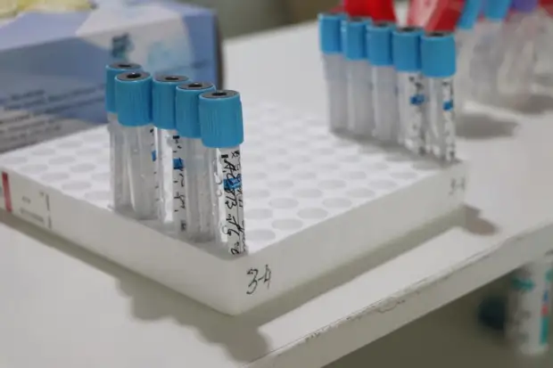 В Приморье за сутки выявлен 151 случай заражения коронавирусом