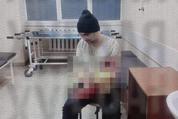 «Страна.ua»: житель Одессы травмировал руку из-за опасений быть мобилизованным