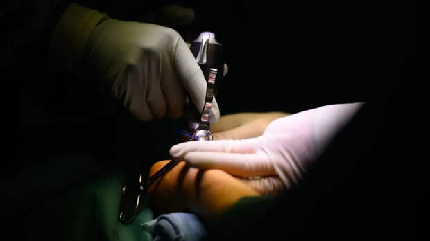 В НИИ им. Склифосовского запущена уникальная программа трансплантации кистей рук