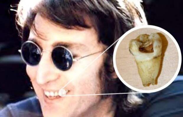 5. Зуб Джона Леннона за 30 тыс долларов купил канадский стоматолог. Символично! автограф, артисты, аукцион, безумные покупки, знаменитости, фанаты, фото