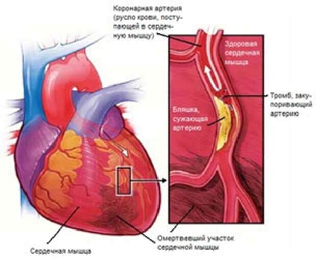 Механизм тромборезистентности сосудистой стенки