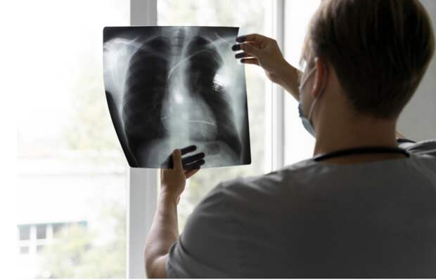 Рак легкого теперь можно предугадать: российские ученые представили новую технологию