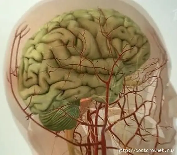 Видео сосудов головного мозга. Патология сосудов головного мозга. Лопание сосудов головного мозга.