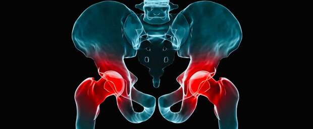 Показания и преимущества магнитно-резонансной томографии тазобедренных суставов