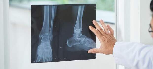 Рентген суставов: что показывает, подготовка, противопоказания и цена