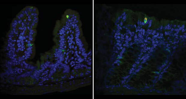 norovirus in mouse tissue