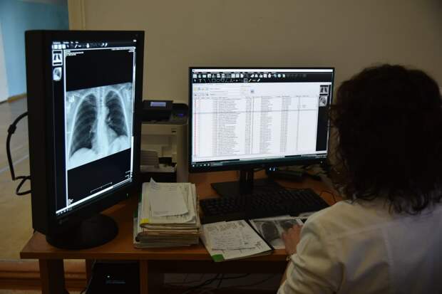 За первую неделю 2026 года в ХМАО зафиксирован рост заболеваемости внебольничными пневмониями