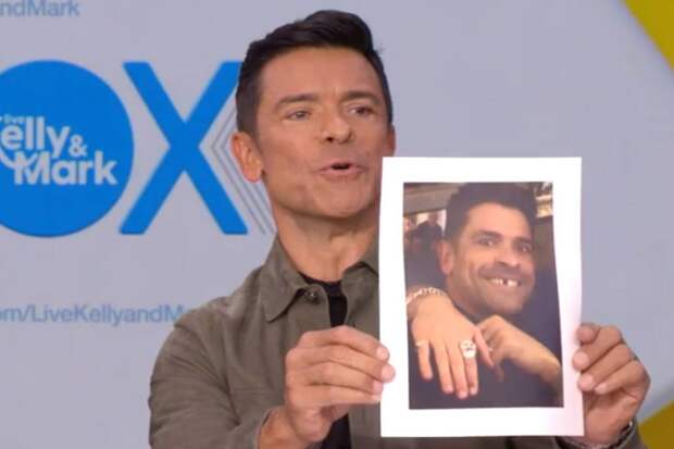 Известный актер показал улыбку без зуба и раскрыл неожиданную причину его отсутствия