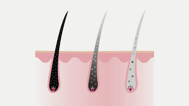 Откуда берется седина