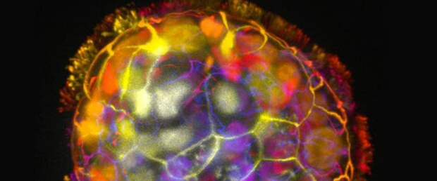 Биороботы из клеток человека восстановили поврежденную нервную ткань