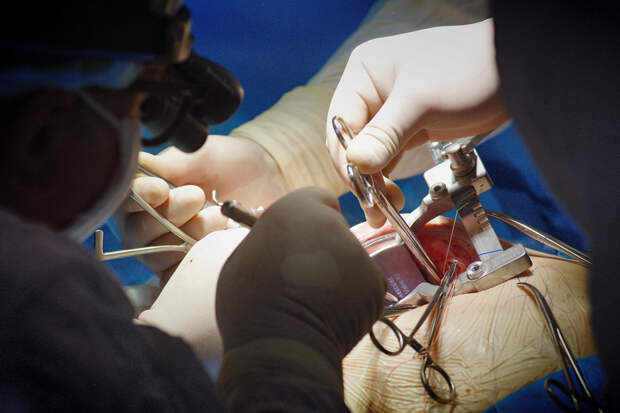 Новосибирские хирурги спасли орган пациенту с донорским сердцем