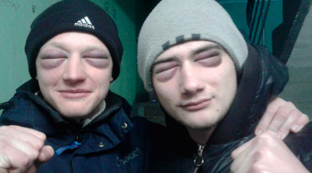 Хозяйственное мыло в быту
