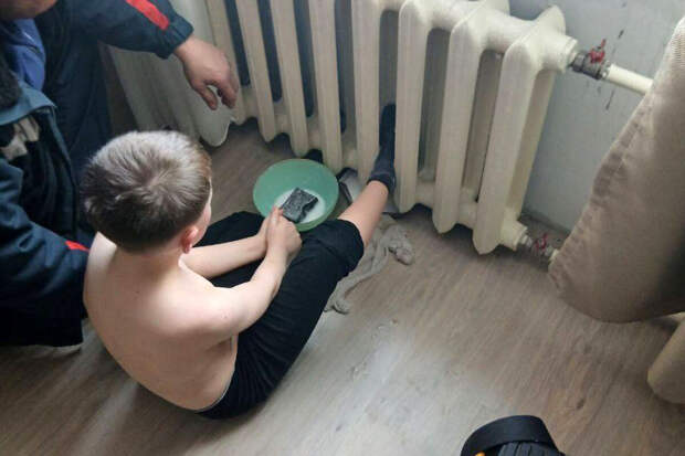 В Бурятии семилетний мальчик чуть не обварил ногу, застряв в горячей батарее