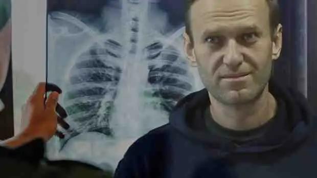 Жалкое зрелище – Навальный пытался выдать простуду за туберкулез