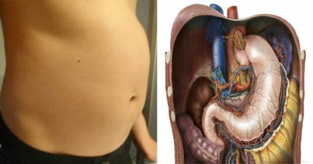 8-common-reasons-why-you-feel-bloated-all-the-time-and-how-to-fix-the-problem