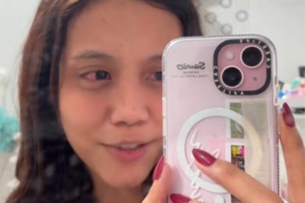 Asia One: в Сингапуре женщина носила контактные линзы и занесла инфекцию в глаза