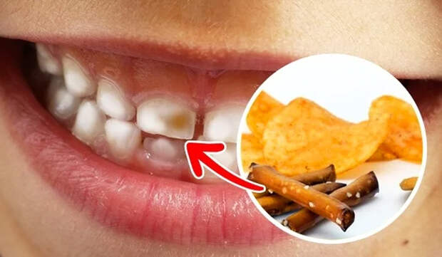 9 продуктов, от которых портятся зубы