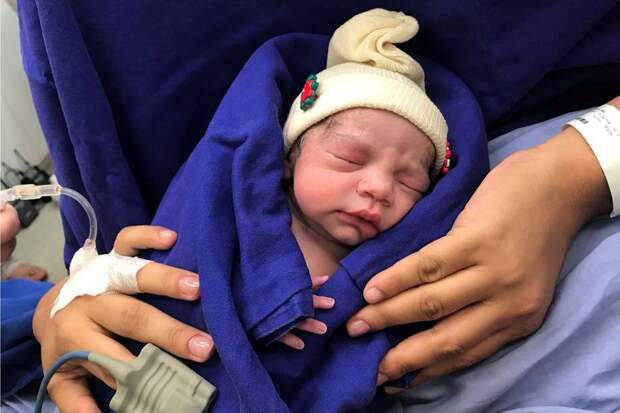 This Dec. 15, 2017 photo provided by transplant surgeon Dr. Wellington Andraus shows the baby girl born to a woman with a uterus transplanted from a deceased donor at the Hospital das Clinicas of the University of Sao Paulo School of Medicine, Sao Paulo, Brazil, on the day of her birth. Nearly a year later, mother and baby are both healthy. (Courtesy Dr. Wellington Andraus via AP) Photo: Associated Press