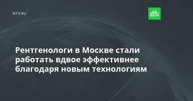 Рентгенологи в Москве стали работать вдвое эффективнее благодаря новым технологиям
