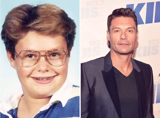 FormerlyAwkwardCelebs04 Вечно недовольны собственной внешностью? Всего 20 фото докажут, что надежда есть!