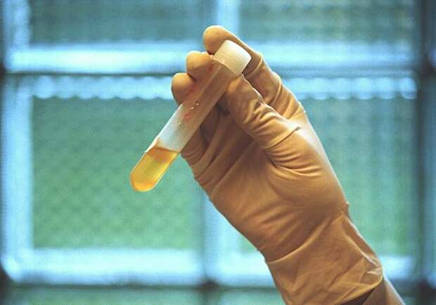 DailyMail: Вирусы обрушиваются на Великобританию как из рога изобилия