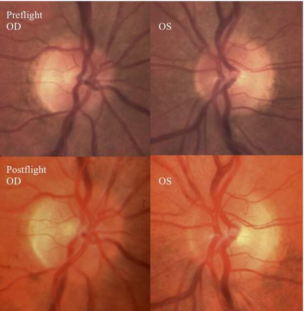 pre and post flight optic disc images