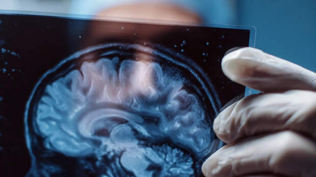 Коварная слепота: мужчина узнал о смертельном диагнозе из-за этикетки шампуня