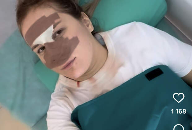 Россиянка сделала пластику под местной анестезией и назвала результат адом