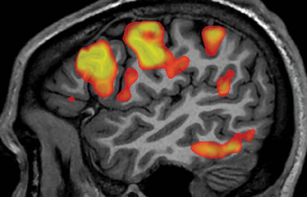 Как работает устройство для чтения мыслей. Искусственный интеллект распознает слова и фразы по активности мозга. Как работает устройство для чтения мыслей. Искусственный интеллект распознает слова и фразы по активности мозга. Фото.