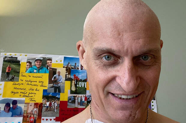 Тиньков потерял волосы после химиотерапии