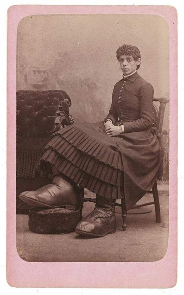 Родившаяся с красивым лицом и гигантскими ногами Фанни Миллс имела приданное 5000 $ наличными и "процветающую ферму" в штате Огайо, доставшуюся ей от отца исторические снимки, странности, страшно, фото, цирк уродов