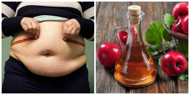 Лечение ожирения яблочным уксусом