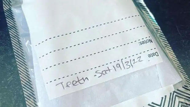 Сотрудники ресторана ищут клиента, забывшего свои зубы