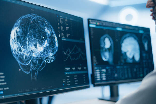 Судмедэксперт Решетун: хорошее снабжение мозга кислородом – залог его здоровья