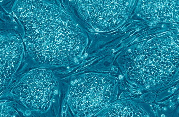 stemcell
