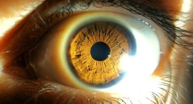 5 болезней, которые можно диагностировать по состоянию глаз