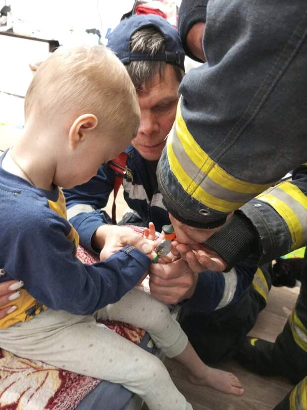 В Архангельске спасатели помогли ребенку снять игрушечное кольцо с пальца