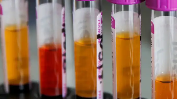 Врач рассказала об особенностях экспресс-тестов на антиген к COVID-19