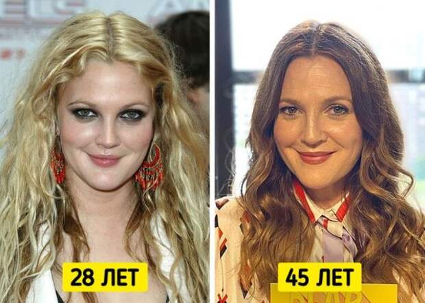 Знаменитые женщины, которые отказались от уколов красоты