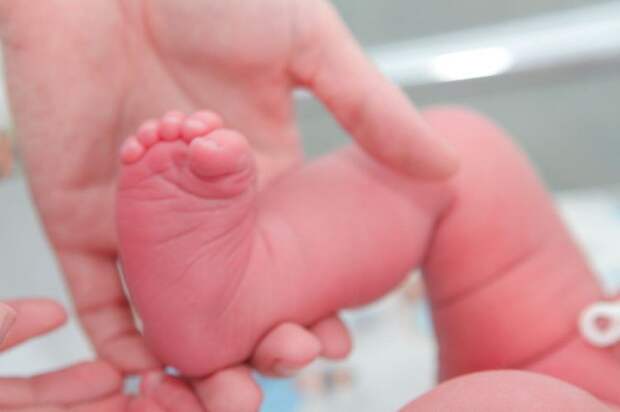 Чудо! Крошечный герой: младенец весом 700 граммов выжил и окреп